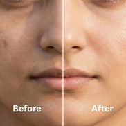 Whitening Cream with Melazero